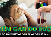 Câu Chuyện Kỳ Lạ Về Người Đàn Ông Mang Sán Dây Trong Tủy Suốt 12 Năm