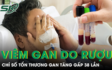 Câu Chuyện Kỳ Lạ Về Người Đàn Ông Mang Sán Dây Trong Tủy Suốt 12 Năm
