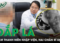 Khám Phá 3 Loại Cá Dân Dã Tuyệt Vời ở Việt Nam: Nguồn Omega-3 và Canxi Dồi Dào