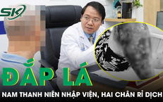 Khám Phá 3 Loại Cá Dân Dã Tuyệt Vời ở Việt Nam: Nguồn Omega-3 và Canxi Dồi Dào