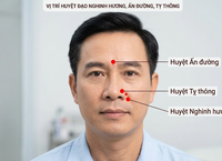 Khám Phá 5 Công Thức Nấu Canh Củ Sen Bổ Dưỡng Cho Sức Khỏe