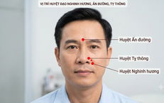 Khám Phá 5 Công Thức Nấu Canh Củ Sen Bổ Dưỡng Cho Sức Khỏe