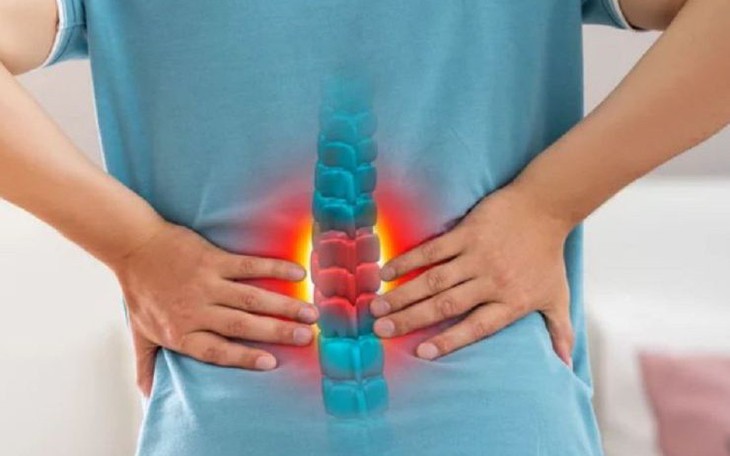 Nguyên nhân và triệu chứng đau lưng dưới- Ảnh 1.