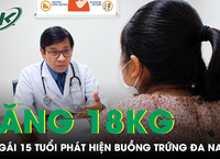 Những Nguyên Nhân Có Thể Khiến Bạn Bị Đau Đầu Mỗi Ngày