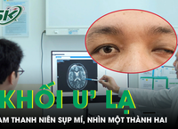 Câu Chuyện Thương Tâm Của Cậu Bé 6 Tuổi Gặp Tai Nạn Nghiêm Trọng