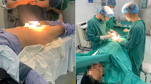 Cảnh Báo Về Gãy Dương Vật: Những Điều Cần Biết Để Bảo Vệ Sức Khỏe