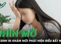 Lợi Ích và Rủi Ro của Que Cấy Tránh Thai: Nên Hay Không?