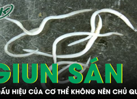 Nỗi Đau Từ Căn Bệnh Hiếm Gặp: Một Góc Nhìn Từ Cuộc Sống Thực Tế