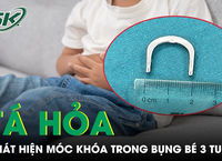 Câu Chuyện Cảnh Giác Khi Lái Xe: Một Giây Chút Lơ Đãng Có Thể Đổi Cuộc Đời