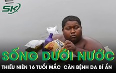 Cảnh Báo Về Sức Khỏe: Nguyên Nhân Tử Vong Từ Thói Quen Ăn Uống
