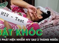 Nguy Cơ Từ Biến Chứng Sau Phẫu Thuật Cắt Mí: Một Câu Chuyện Cảnh Tỉnh