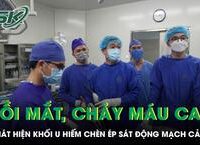 Người Đàn Ông Gặp Nạn Từ Ong Vò Vẽ: Câu Chuyện Cảnh Báo Về An Toàn