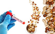 Bệnh Viện S.I.S Cần Thơ Nhận Chứng Nhận SILC: Đạt Chuẩn Quốc Tế Về Đột Quỵ