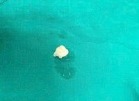 Hành Trình Khôi Phục Thính Lực: Câu Chuyện Của Một Người Đàn Ông Sau 3 Năm Chống Chọi Với Chóng Mặt Và Ù Tai