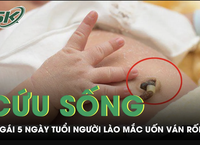 Hậu Quả Nghiêm Trọng Từ Việc trẻ nhỏ Nuốt Phải Pin Cúc Áo