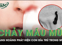 Cảnh Báo Về Mối Nguy Hiểm Từ Móc Câu Đánh Nhau