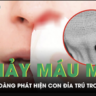 Cảnh Báo Về Mối Nguy Hiểm Từ Móc Câu Đánh Nhau