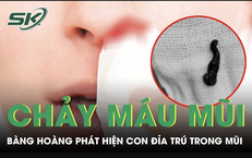 Cảnh Báo Về Mối Nguy Hiểm Từ Móc Câu Đánh Nhau