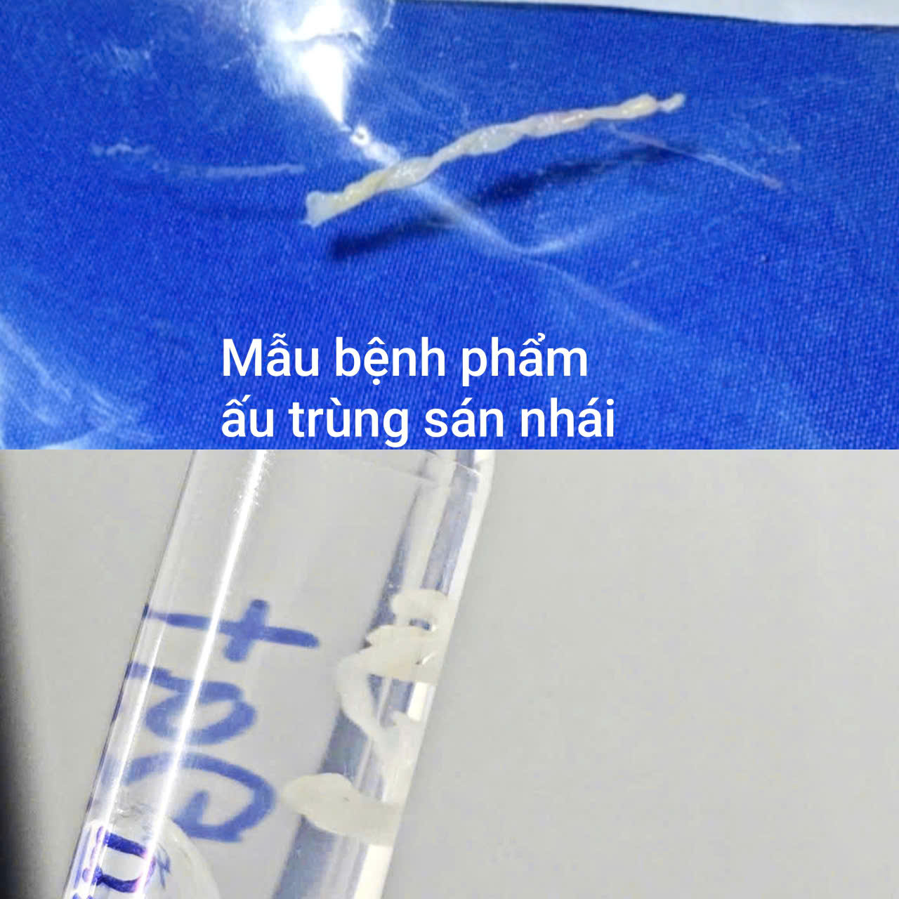 Cảnh Báo: Nguy Hiểm Khi Uống Nước Suối Khi Bơi - Ảnh 2.