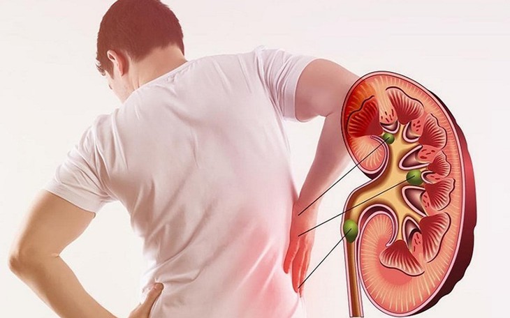 Bệnh thận mạn: Khi nào cần dùng statin? - Ảnh 1.