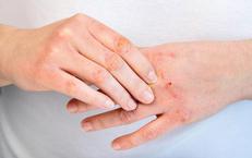 HIV: Tương Lai Sống Khỏe Với Điều Trị ARV