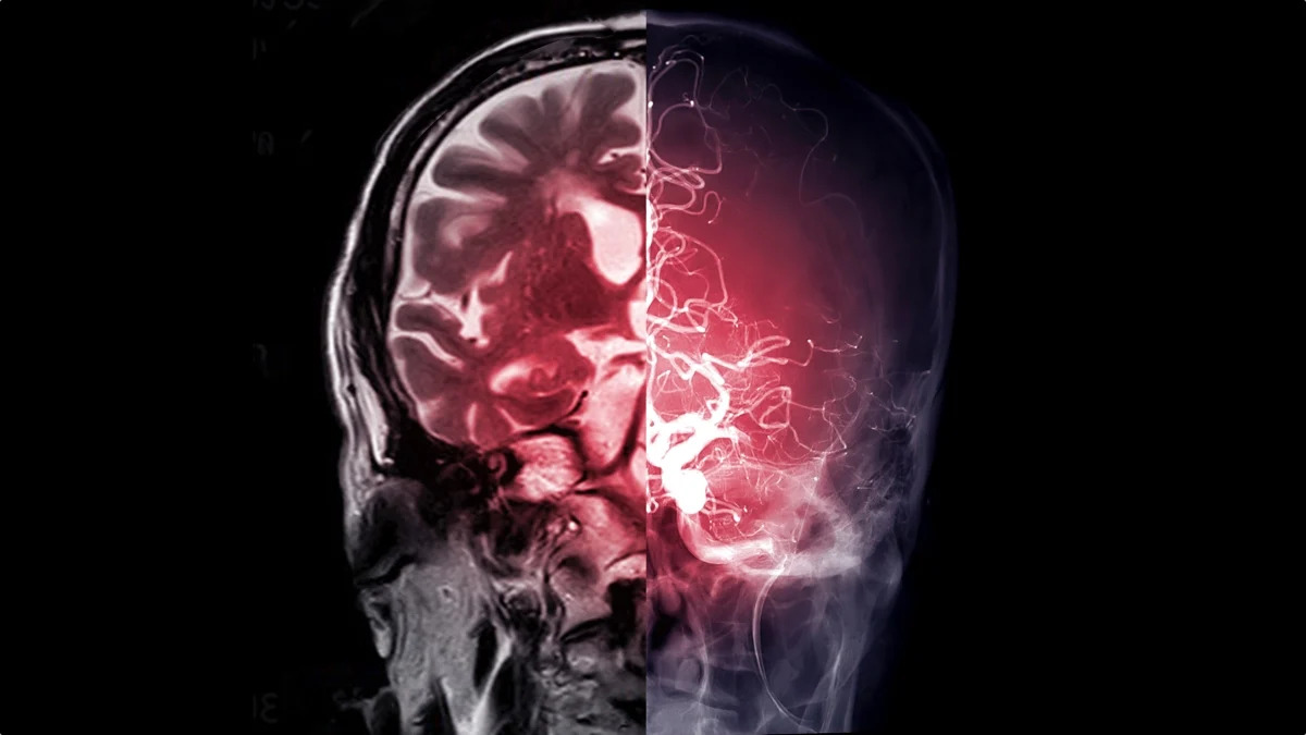 brain-glow-scan-jpg-17856095883171363155033 Khám phá khả năng thao túng não bộ của metformin trong điều trị đái tháo đường - Ảnh 2.