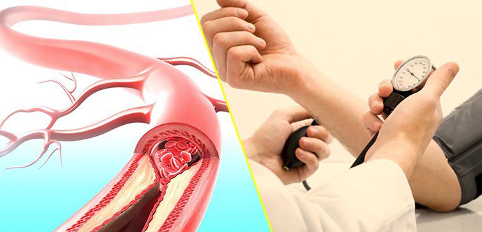 Chóng mặt do thời tiết gây ra - Ảnh 1. Chóng mặt do thời tiết gây ra - Ảnh 1.