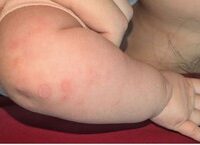 Giải Pháp Lưu Giữ Tế Bào Gốc Từ Máu và Mô Dây Rốn Tại PhenikaaMec