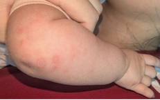 Giải Pháp Lưu Giữ Tế Bào Gốc Từ Máu và Mô Dây Rốn Tại PhenikaaMec