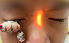 Mỡ Máu Cao: Nguy Cơ Tiềm Ẩn Gây Biến Cố Tim Mạch