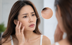 Lựa Chọn Tập Luyện Hoàn Hảo Cho Người Trên 50 Tuổi Với Acid Uric Cao