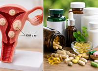 Những Thực Phẩm Bổ Sung Cần Tránh Khi Dùng Canxi
