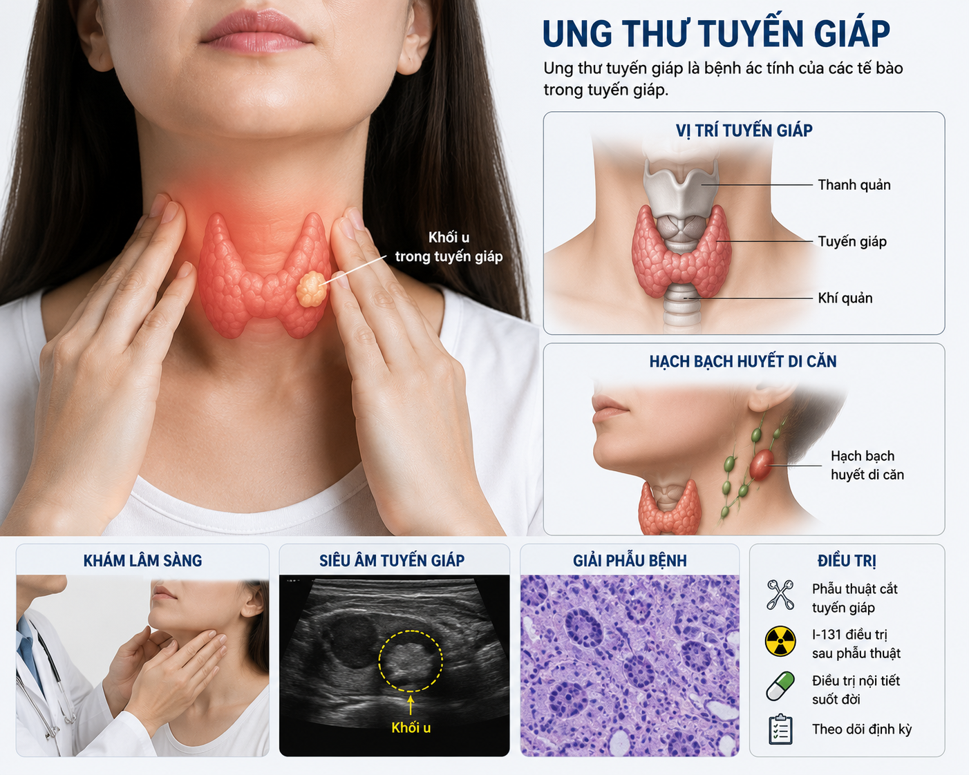 dieu-tri-ung-thu-tuyen-giap-1785045496489424129158 Sau mổ ung thư tuyến giáp, ai cần điều trị I-131? - Ảnh 1.