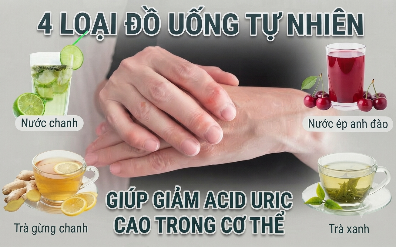 Mối Liên Hệ Giữa Hoạt Động Thể Chất và Cơn Gout Sau Tuổi 50
