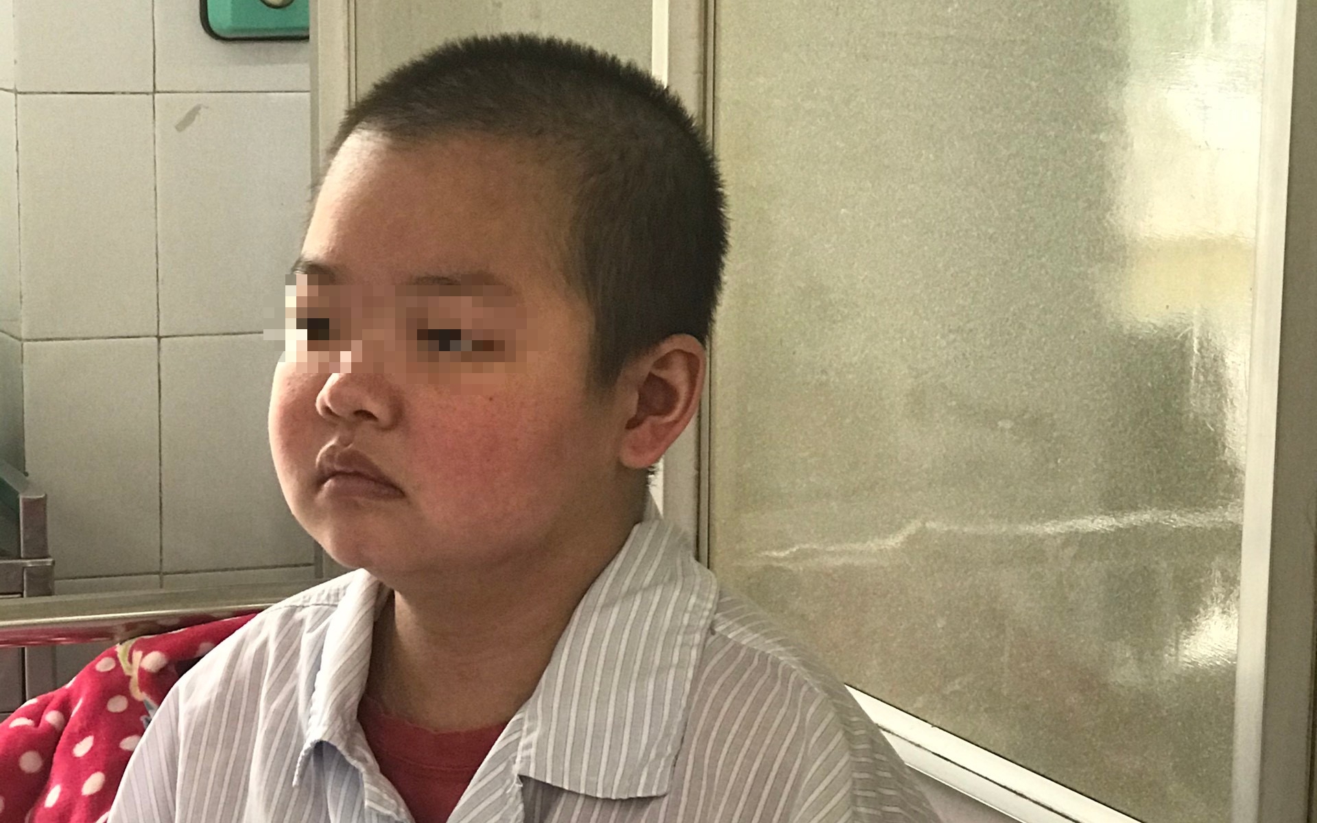 Cẩm nang chăm sóc răng miệng cho bệnh nhân Lupus