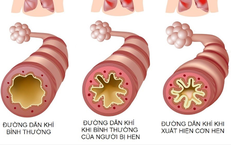 Cảnh Giác: Dấu Hiệu Cần Nhận Biết Khi Trẻ Sặc Nước