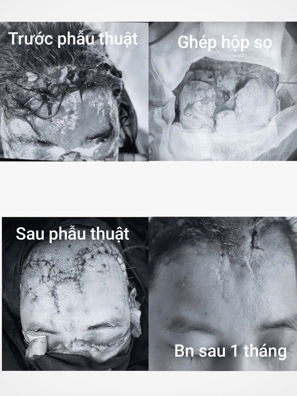Hình ảnh chấn thương trước và sau phẫu thuật.