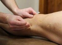 Giải Pháp Can Thiệp Nội Mạch Đối Với Bệnh Nhân Phình Động Mạch Chủ Ngực Khổng Lồ