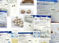Phát Hiện Ca Thứ 44 Nhiễm Giun Rồng Tại Việt Nam: Điều Gì Cần Biết?