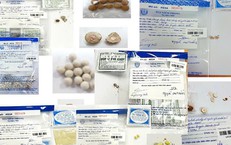 Phát Hiện Ca Thứ 44 Nhiễm Giun Rồng Tại Việt Nam: Điều Gì Cần Biết?
