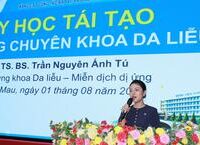 Thời Điểm Vàng Uống Trà Lá Sen Để Giảm Cân Hiệu Quả