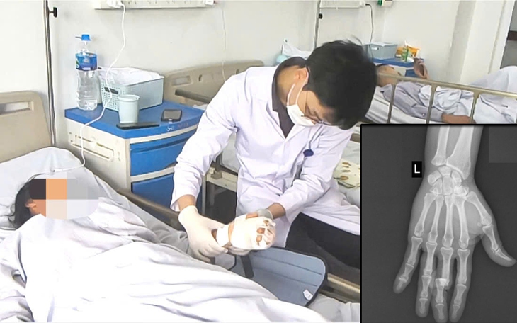 Bệnh viện tuyến tỉnh chạy đua với thời gian nối chân đứt gần lìa cho bệnh nhân- Ảnh 2.