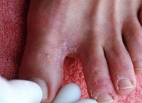 Tiêm Vaccine HPV: Khởi Đầu Bảo Vệ Sức Khỏe Trẻ Gái Từ Sớm