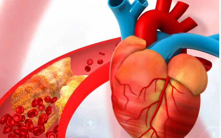 Mối Liên Hệ Giữa Sức Mạnh Cơ Bắp và Nguy Cơ Bệnh Tim Mạch