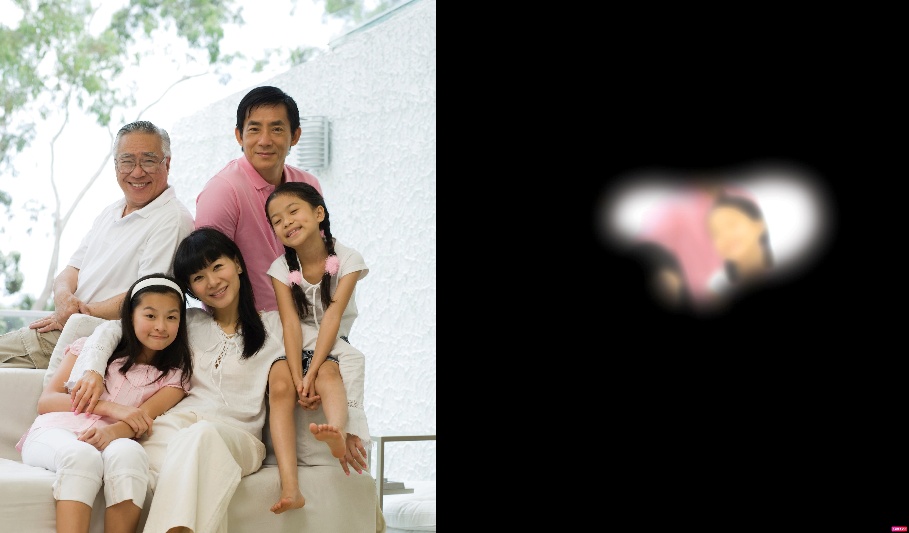 Hiểu Biết Về Glaucoma: Dấu Hiệu, Nguy Cơ Và Phương Pháp Điều Trị