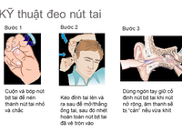 Bé Gái 2 Tháng Tuổi Nhiễm Giang Mai: Tầm Quan Trọng Của Kiểm Tra Sức Khỏe Trong Thai Kỳ