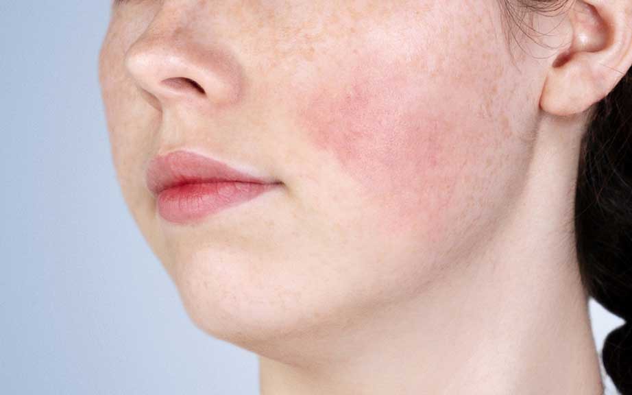 Thoa retinol quanh vùng mắt có tác dụng gì? - Ảnh 3.