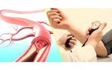 Tầm Quan Trọng Của Khám Sức Khỏe Định Kỳ Đối Với Người Lao Động Khỏe Mạnh