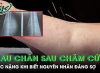 Hành Trình Chữa Bệnh Tiểu Đường Qua Thực Phẩm Tự Nhiên: Câu Chuyện Của Một Người Đàn Ông 55 Tuổi