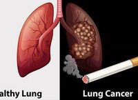 Cảnh Báo An Toàn: Trẻ Nhỏ Có Nguy Cơ Nuốt Dị Vật Nguy Hiểm